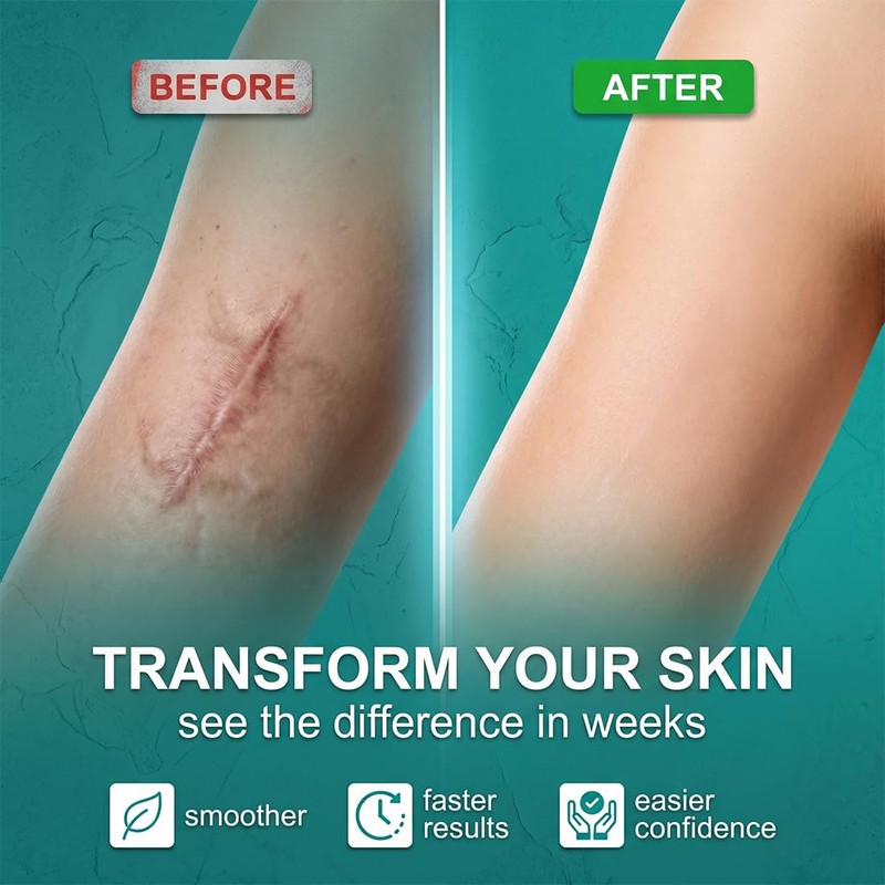 JHAZUN Crema Per Cicatrici,Sbiadisce Le Smagliare,Protegge e Ripara La Texture