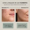 Toallitas Faciales Secas Desechables Extra Gr Elementa 300pz