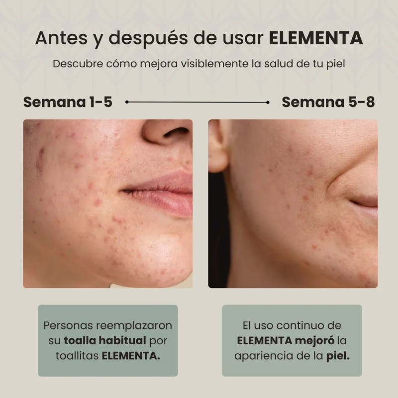 Toallitas Faciales Secas Desechables Extra Gr Elementa 300pz