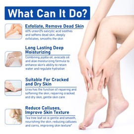 Urea Cream 60% For Feet Maximum Strength, Urea Foot Lotion With 2% Salicylic Acid For Dry Cracked Feet, Heel, Hand & Knee, 5.3 oz Exfoliating Foot Care For Dead Skin, Softening & Deep Moisturizing