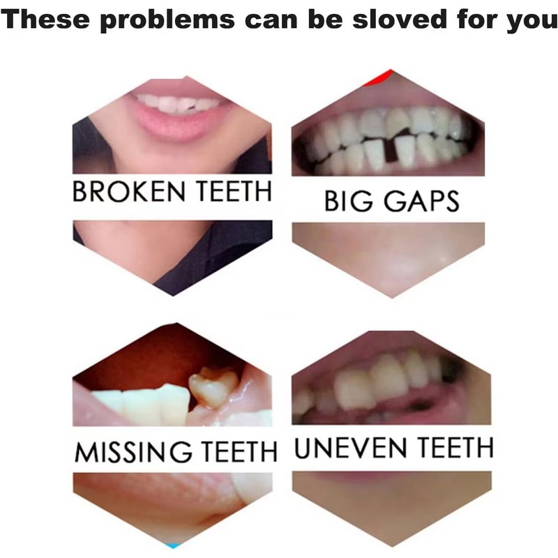 Fake Tooth Repair Kits for Filling The Missing Broken Tooth