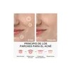 180pzs Parches Pegatinas Para Acné Absorbentes Pimple Patch