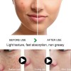 Crema Facial Despigmentante Y Anti Manchas Pack 2 Pzs Todo