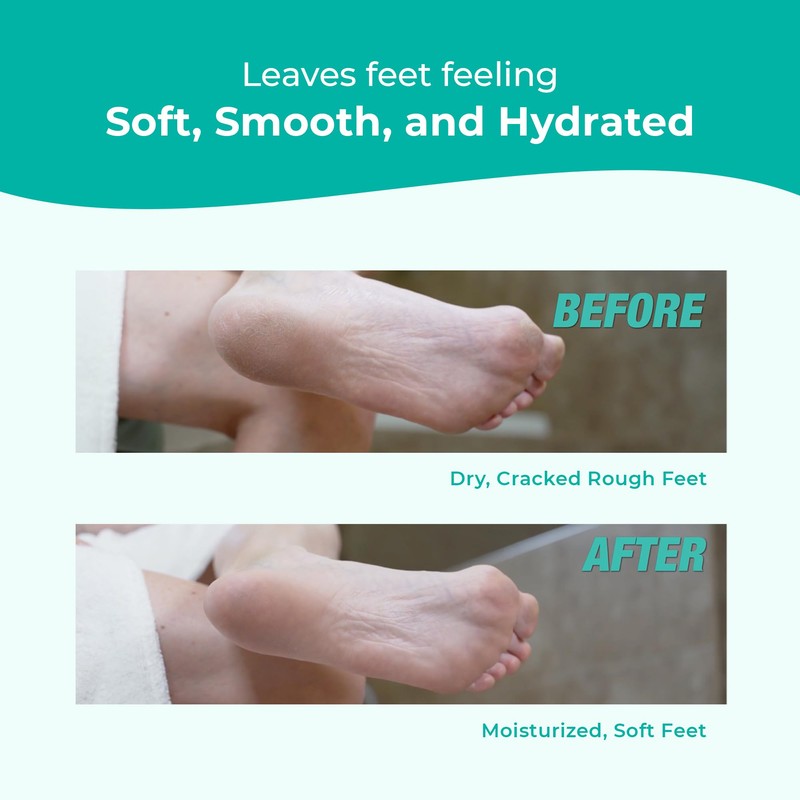 RICHENNA EZ Foot Care Cream - Advanced Exfoliating Urea Foot