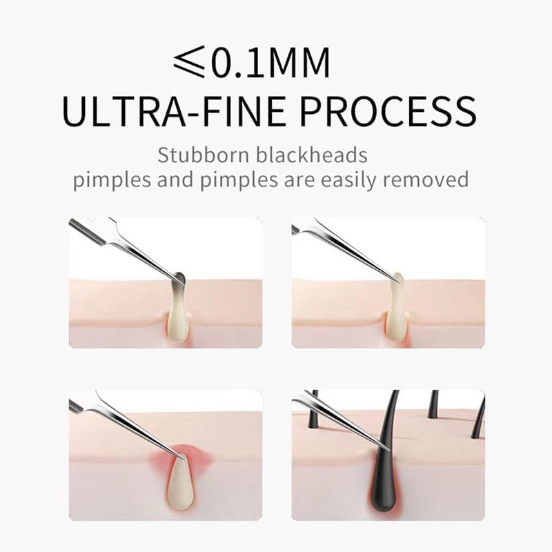 3 Pcs Professional Blackhead Tweezer Professional Facial Blackhead Remover Tweezers