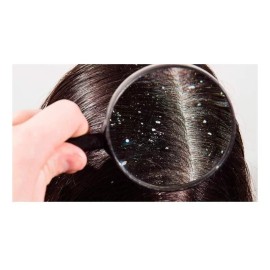 Celesty Shampoo De Alquitrán Anticaspa 1lt