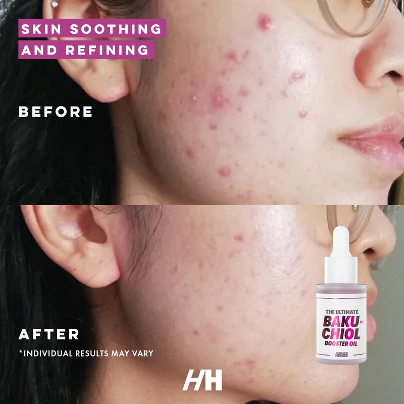 Handmade Heroes 2% Bakuchiol Oil Lifting and Firming Oil for