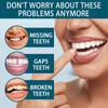 1 Pairs of Temporary Teeth for Women and Men/Cosmetic Denture