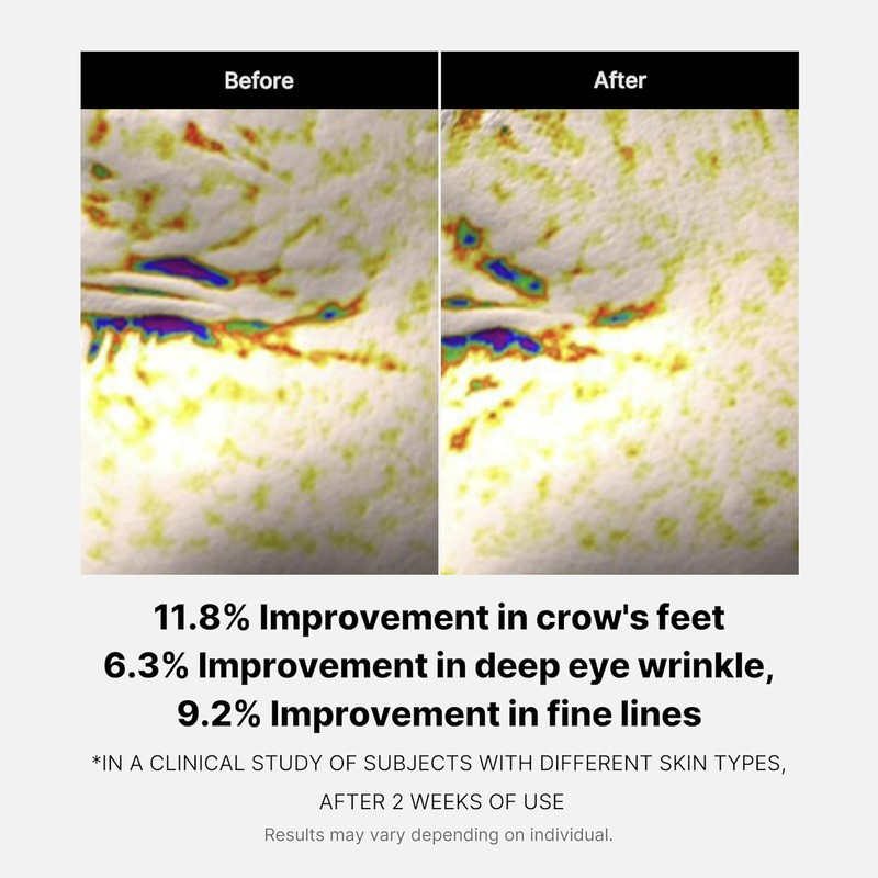 MEDICUBE [MEDICUBE]Deep Lifting Peptide Eyecream For Face 30ml