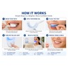 Blue Light Teeth Whitening Device for Home Use – Professional