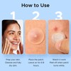LitBear 3 IN 1 Acne Patch for Face, 7 Sizes