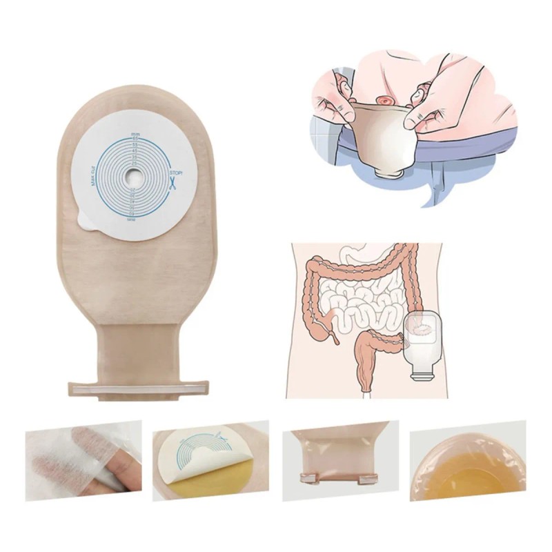 Bolsa De Colostomía Desechable Para Adultos 10 Unidades
