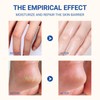 Urea 60% Foot Cream 40 g, Intensive Moisturiser Against Calluses,