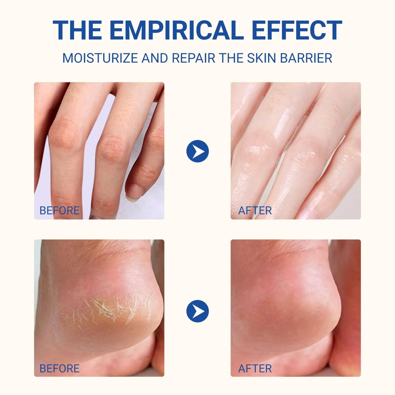 Urea 60% Foot Cream 40 g, Intensive Moisturiser Against Calluses,