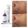 Sérum Concentrado Mela B3 Antimanchas 30ml Despigmentante