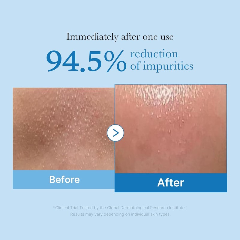 MEDICUBE [MEDICUBE]Zero Pore Blackhead Deep Cleansing Oil 205ml