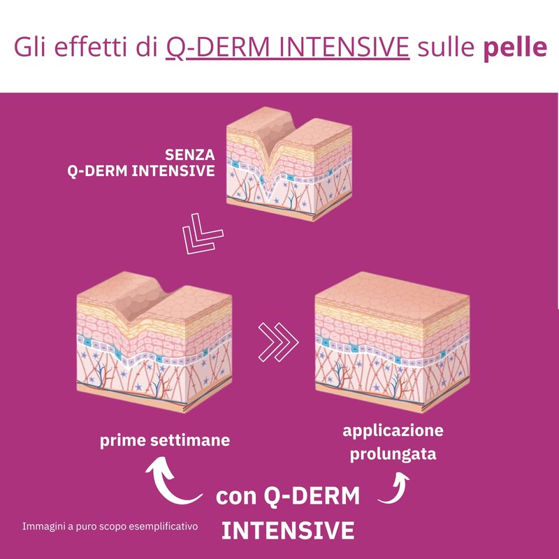 Q1 Q-Derm Intensive Anti-Wrinkle Cream for Women with Refreshing and