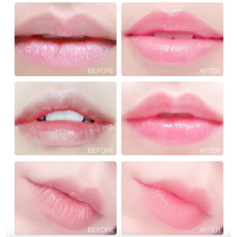 Frasco Parches Labios Mascarilla Hidratante Colágeno Normal