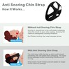 Snoring Chin Strap - Snoring Solution Comfortable Anti Snoring Devices