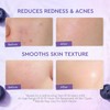crema facial con 5X Ceramides y Blueberry, crema para la