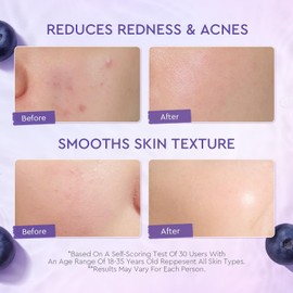 crema facial con 5X Ceramides y Blueberry, crema para la barrera de la piel con hidratación profunda, 100 g