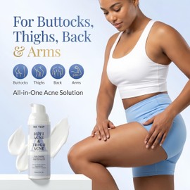 Butt & Thigh Acne Cream – Fast Acting Exfoliating Body Lotion for Zits, Razor Bumps & Dark Spots – Smoothing for Rough & Bumpy Skin with AHA, Tea Tree Oil & Salicylic Acid (3.4o.z/100ml)