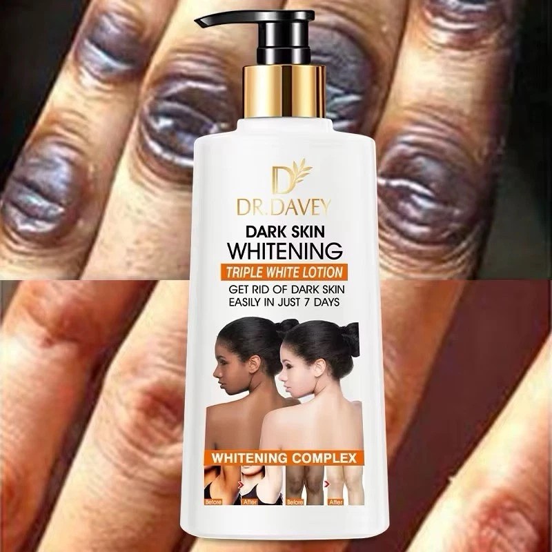 DR DAVEY Dark Skin Tripple Whitening Face Body Lotion 500ml