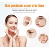 Facial Essence 30ml VC Original Solution moisturizing Bright Skin Dark