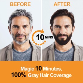 Men's Brown Beard Dye, Dark Brown Hair Dye for Gray Hair Coverage, 3 in 1 Hair Dye Shampoo, Mustache & Beard Dye for Men, Quick & Easy to Use at Home, Long Lasting Beard Color for Men 200ML