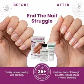 Set de Fortalecedor de Uñas y Crema para Cutículas DermaNail - Kit de Cuidado de Uñas de Dedos con Fortalecedor Líquido de Uñas y Crema Cutemol (Muestra de 11.5g) Crecimiento Saludable - Reparación