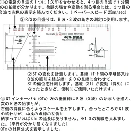 ECG Scale 25-3032 70 x 1.5 x 165mm /8-1212-01