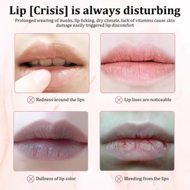 XdealCozyxc 3PCS UK Honeybalm Lip Balm, Honey Strawberry Watermelon Lip Mask, Moisturizing & Hydrate Repair Prevent Dry Cracked Lip Care