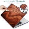 TWOLSKOO for MacBook Pro 16 inch Case M4 A3403 A3186