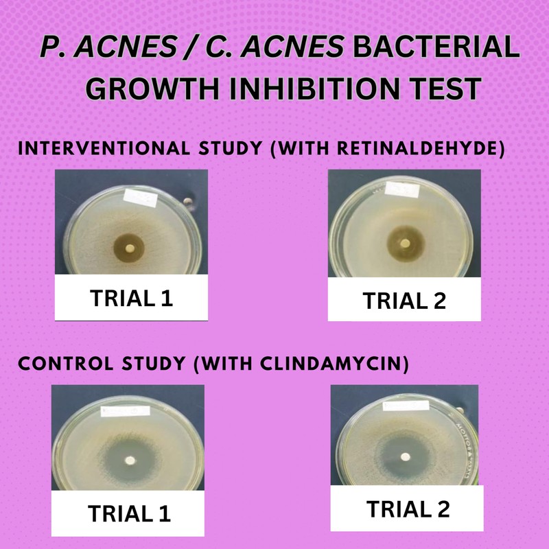 Anti-Bacterial Pimple Patches | Fast Acne-Drying Treatment | Dual Action