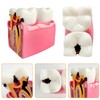 Dental Caries Teeth Model, 3.4 x 3 x 2 Inches