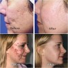 Mafab 3 Pieza Esencia Ácido Hialurónico Cuidado Facial Reparador F