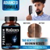 NutraPro Mens Hair Growth-Hair Vitamins For Men. Anti Hair Loss