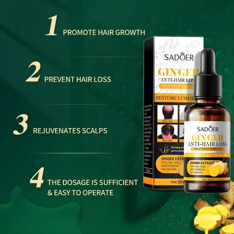 Tratamiento Para Exceso Caida Cabello Mujer Fortalece 30ml