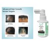 Hushveda Advanced Hair Growth Serum Concentrate 30ml Rosemary, 3% Redensyl,