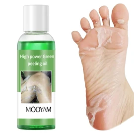Exfoliating Green Peeling Oil for Extra Strength Exfoliation, Exfoliating Peeling Solution for Body and Face Skin Peeling Chemical Peel At Home