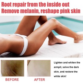 Esencia Rosa para Partes Intimas - Esencia Rosa Zona Íntima | Zona íntima Dark Spot Corrector Pink Private Parts Serums para Rodillas, Codos, Axilas y Muslos