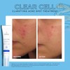 IMAGE Skincare, CLEAR CELL Clarifying Acne Spot Treatment, with Salicylic
