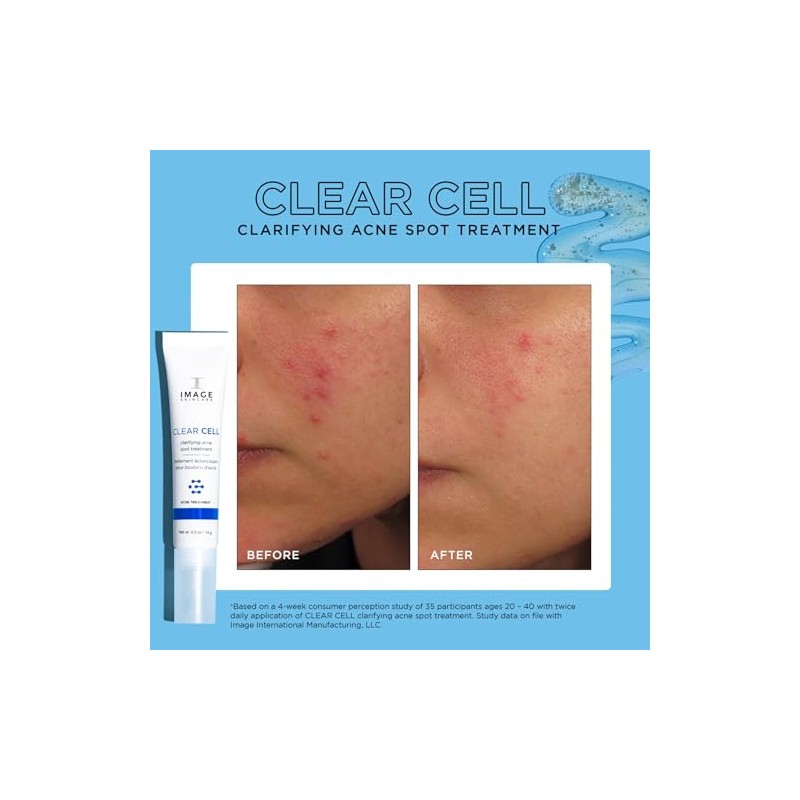 IMAGE Skincare, CLEAR CELL Clarifying Acne Spot Treatment, with Salicylic