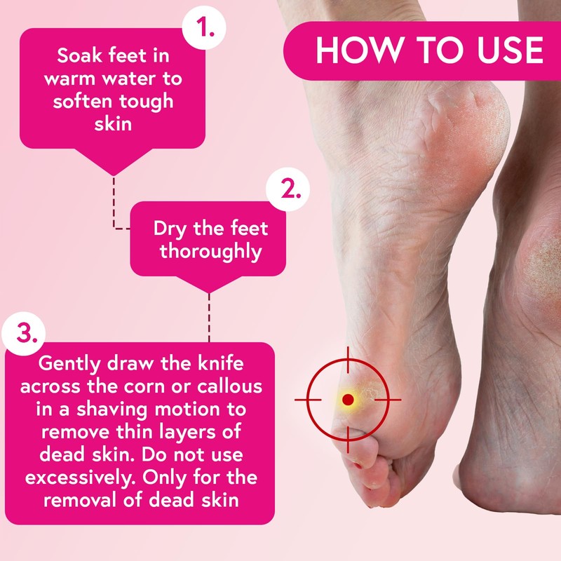 CARNATION Corn & Callous Safety Remover for immediate Removal of