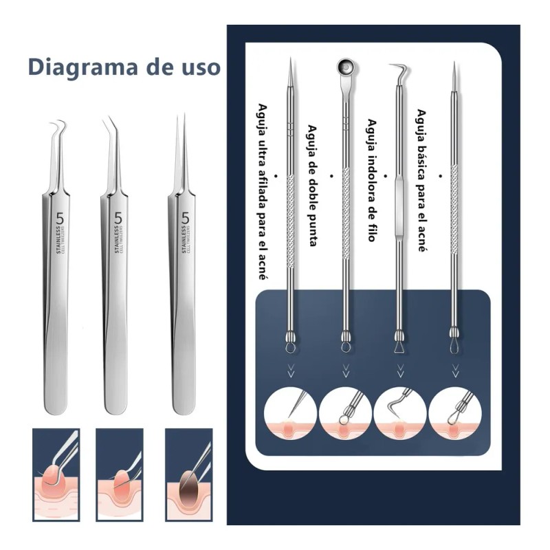 Limpiador Facial Ultrasónico Exfoliante Espinillas Belleza Blanco