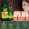 7 Day Hair Growth 3x Ginger Hair Growth Germinal Oil,