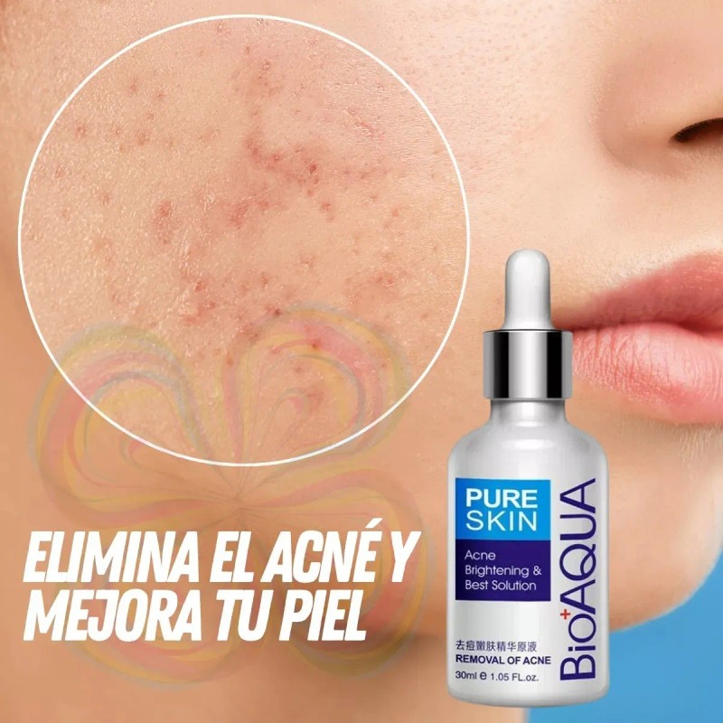 Serum Skin Care Elimina Acné Granos Espinillas Piel Facial F