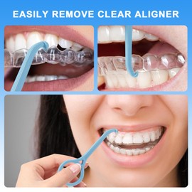 NAYSAYE Aligner Remover Tool, Braces Removal Tool Kit for Retainer Cleaning, Portable Oral Care Braces Accessory, 20 PCS, Green, Blue, Light Pink, Yellow