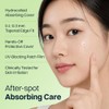 FRANZ Naked Active Spot Patches - Hydrocolloid Pimple Treatment