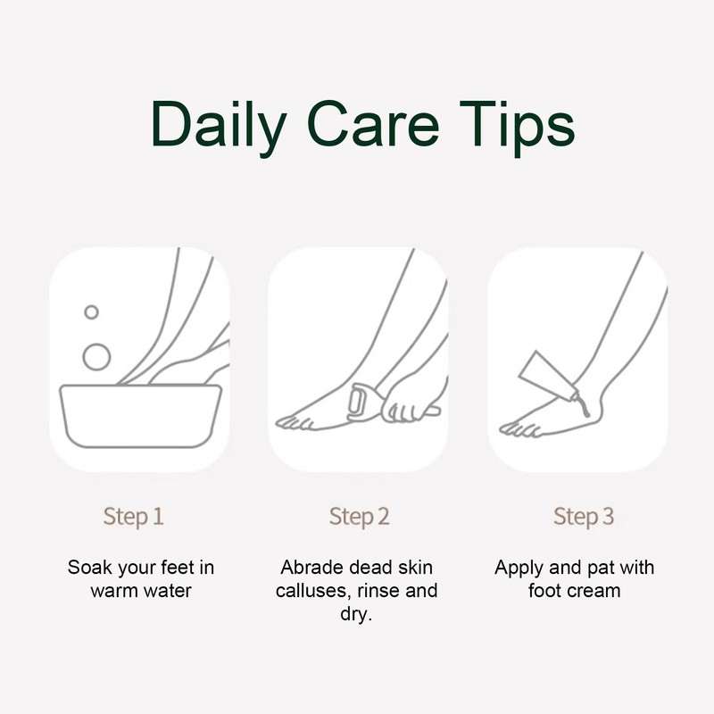 Electric Foot Callus Remover Rechargeable Painless 3 Speed Gentle Exfoliation